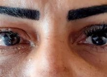 زنی در جستجوی زیبایی خود را نابینا کرد