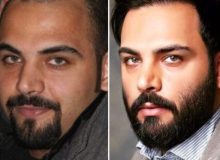 عکس‌های احسان علیخانی قبل از کاشت مو لو رفت