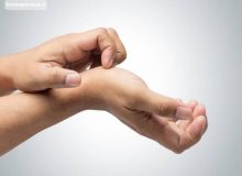 خارش کف دست‌ نشانه پول‌دارشدن نیست!