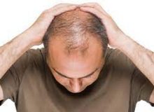 آیا افسردگی می‌تواند موجب ریزش مو شود؟