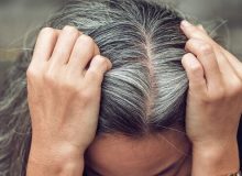 آیا استرس واقعا عامل سفیدشدن مو است؟