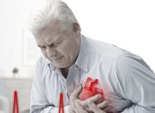 سکته قلبی را چطور ناکام کنیم؟