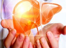 خاصیت گیاه مورد علاقه ابوعلی سینا برای کبد